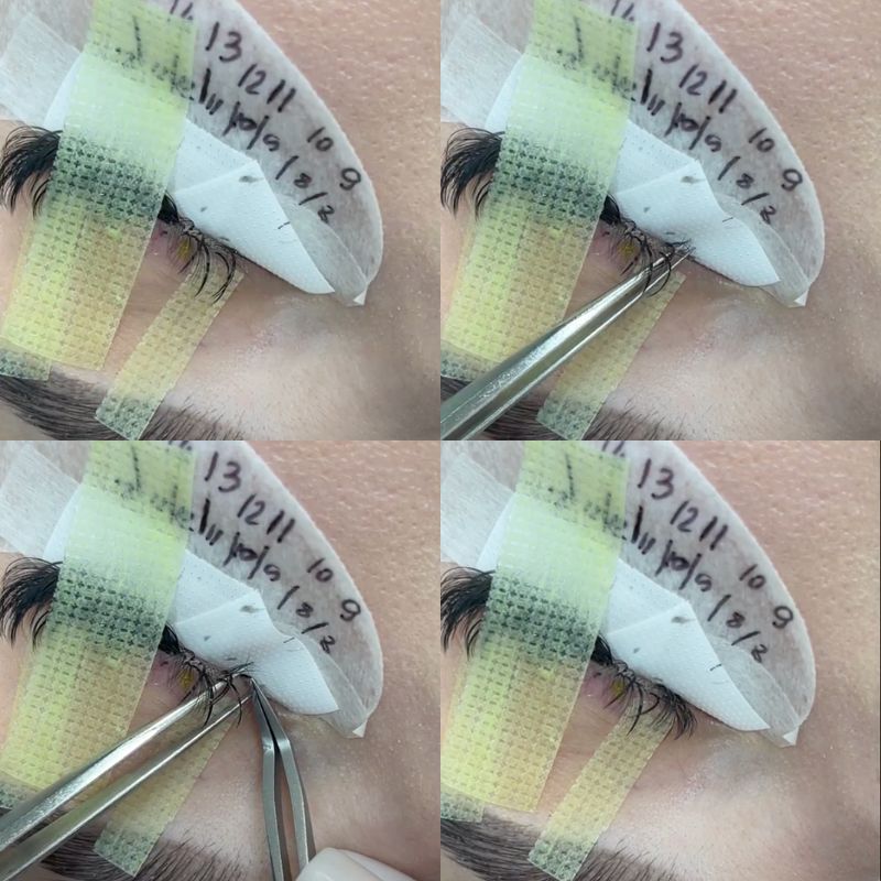 Sensitive Nexcare Skin Tape